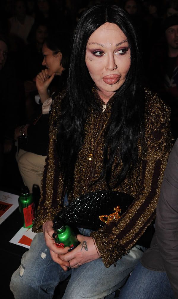 pete burns lips. pictures of pete burns