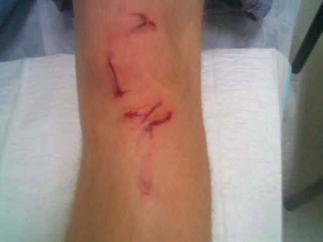knee.jpg