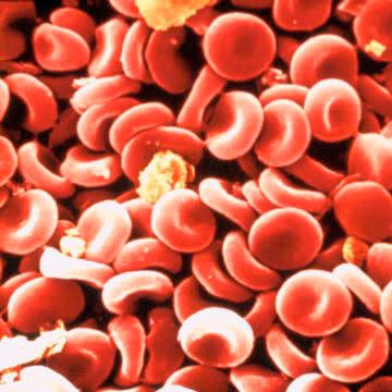 own red blood cells are harvested, tagged with radioactive material,